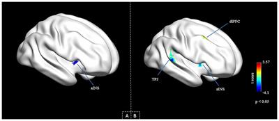 Aberrant Insula-Centered Functional Connectivity in Psychogenic Erectile Dysfunction Patients: A Resting-State fMRI Study